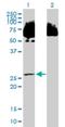 Short Chain Dehydrogenase/Reductase Family 39U Member 1 antibody, H00056948-B01P, Novus Biologicals, Western Blot image 