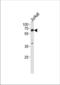 Zeta Chain Of T Cell Receptor Associated Protein Kinase 70 antibody, TA324539, Origene, Western Blot image 