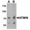ATM Interactor antibody, TA349047, Origene, Western Blot image 