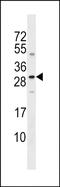 Sclerostin antibody, PA5-71999, Invitrogen Antibodies, Western Blot image 