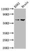 BRCA1-associated protein antibody, CSB-PA773793LA01HU, Cusabio, Western Blot image 