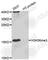 Histone Cluster 3 H3 antibody, A7262, ABclonal Technology, Western Blot image 