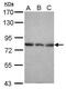 Epsin 2 antibody, PA5-31158, Invitrogen Antibodies, Western Blot image 