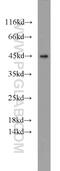 Xyloside Xylosyltransferase 1 antibody, 20913-1-AP, Proteintech Group, Western Blot image 