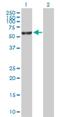 Fanconi anemia group E protein antibody, H00002178-B01P, Novus Biologicals, Western Blot image 