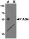 Protein Inhibitor Of Activated STAT 4 antibody, 5747, ProSci, Western Blot image 