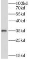 Interleukin 1 Beta antibody, FNab04210, FineTest, Western Blot image 