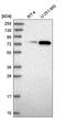 Origin Recognition Complex Subunit 3 antibody, HPA039553, Atlas Antibodies, Western Blot image 