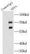 Nuclear Factor I A antibody, FNab05698, FineTest, Immunoprecipitation image 