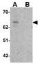 Zinc finger CCCH-type with G patch domain-containing protein antibody, GTX17161, GeneTex, Western Blot image 