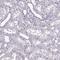 Desmocollin 3 antibody, NBP2-31886, Novus Biologicals, Immunohistochemistry paraffin image 