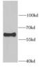 RAD23 Homolog B, Nucleotide Excision Repair Protein antibody, FNab07078, FineTest, Western Blot image 
