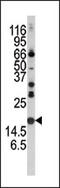 Synuclein Alpha antibody, AP13477PU-N, Origene, Western Blot image 