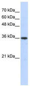 Aldo-Keto Reductase Family 7 Member A3 antibody, TA334423, Origene, Western Blot image 
