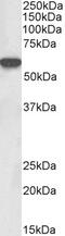 TATA-Box Binding Protein antibody, 42-998, ProSci, Western Blot image 