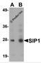 Survival of motor neuron protein-interacting protein 1 antibody, 5823, ProSci, Western Blot image 