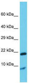 Gremlin 1, DAN Family BMP Antagonist antibody, TA344678, Origene, Western Blot image 
