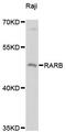 HAP antibody, LS-C748233, Lifespan Biosciences, Western Blot image 