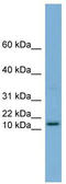 HRK antibody, TA339375, Origene, Western Blot image 