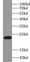 Ubiquitin Conjugating Enzyme E2 H antibody, FNab09176, FineTest, Western Blot image 