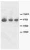 FGFR-2 antibody, AP23313PU-N, Origene, Western Blot image 