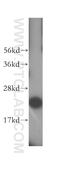 Mitochondrial Ribosomal Protein L11 antibody, 15543-1-AP, Proteintech Group, Western Blot image 