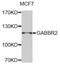 Gamma-Aminobutyric Acid Type B Receptor Subunit 2 antibody, orb373431, Biorbyt, Western Blot image 