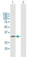 Zinc Finger CCHC-Type Containing 9 antibody, H00084240-B01P, Novus Biologicals, Western Blot image 