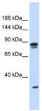 Pleckstrin And Sec7 Domain Containing 3 antibody, TA344111, Origene, Western Blot image 