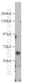 Regulator Of G Protein Signaling 7 antibody, 14056-1-AP, Proteintech Group, Western Blot image 