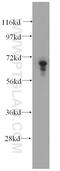 Protein Inhibitor Of Activated STAT 3 antibody, 13486-1-AP, Proteintech Group, Western Blot image 