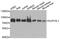 Suv3 Like RNA Helicase antibody, A06759, Boster Biological Technology, Western Blot image 
