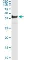 Twinfilin Actin Binding Protein 1 antibody, H00005756-M02, Novus Biologicals, Immunoprecipitation image 