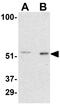 P21 (RAC1) Activated Kinase 2 antibody, GTX31742, GeneTex, Western Blot image 