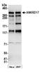 Ankyrin Repeat Domain 17 antibody, A301-663A, Bethyl Labs, Western Blot image 