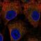 Limbic System Associated Membrane Protein antibody, NBP2-55960, Novus Biologicals, Immunocytochemistry image 