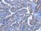 Immunoglobulin Superfamily Member 10 antibody, MBS2520127, MyBioSource, Immunohistochemistry paraffin image 