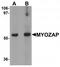 Myocardial Zonula Adherens Protein antibody, TA320110, Origene, Western Blot image 