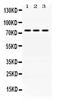 Acyl-CoA Synthetase Long Chain Family Member 1 antibody, PB10025, Boster Biological Technology, Western Blot image 