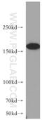 Rho Associated Coiled-Coil Containing Protein Kinase 2 antibody, 20248-1-AP, Proteintech Group, Western Blot image 