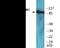 Fibroblast Growth Factor Receptor 1 antibody, EKC2070, Boster Biological Technology, Western Blot image 