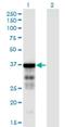 Clusterin Associated Protein 1 antibody, H00023059-M05, Novus Biologicals, Western Blot image 