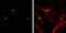 TBR2 antibody, GTX134088, GeneTex, Immunocytochemistry image 