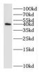 Dual Specificity Phosphatase 11 antibody, FNab02563, FineTest, Western Blot image 