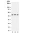 Bone Morphogenetic Protein 5 antibody, R32013, NSJ Bioreagents, Western Blot image 