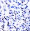 Bone morphogenetic protein 5 antibody, orb213607, Biorbyt, Immunohistochemistry paraffin image 