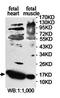 Fatty Acid Binding Protein 3 antibody, orb78380, Biorbyt, Western Blot image 