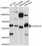 Coronin 2A antibody, LS-C749474, Lifespan Biosciences, Western Blot image 