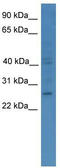 GTP cyclohydrolase I antibody, TA342673, Origene, Western Blot image 