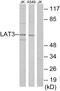 Solute Carrier Family 43 Member 1 antibody, PA5-38543, Invitrogen Antibodies, Western Blot image 